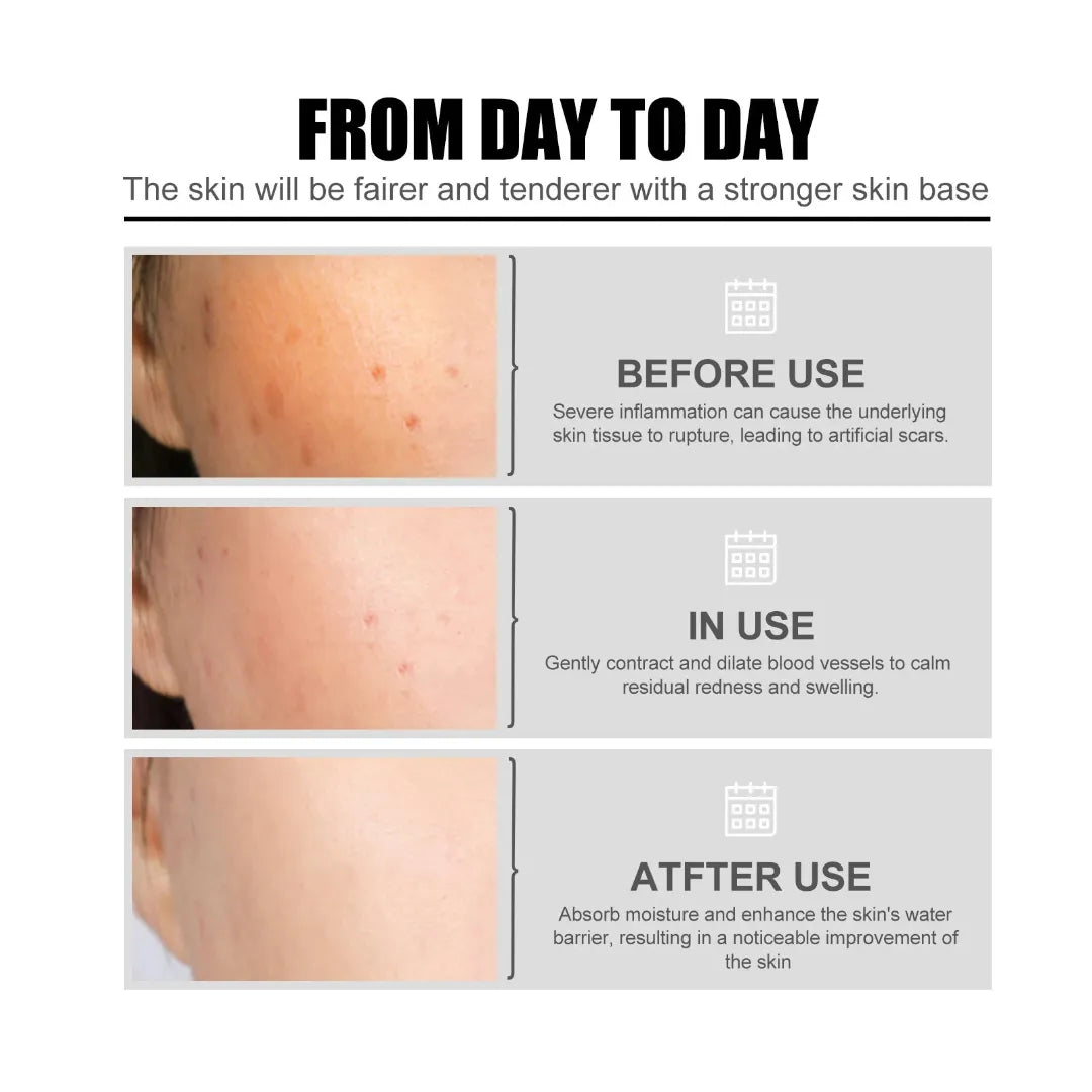 SERUM FACIAL HIDRATANTE CON NICOTINAMIDA - 50 ML Pague 1 Lleve 2
