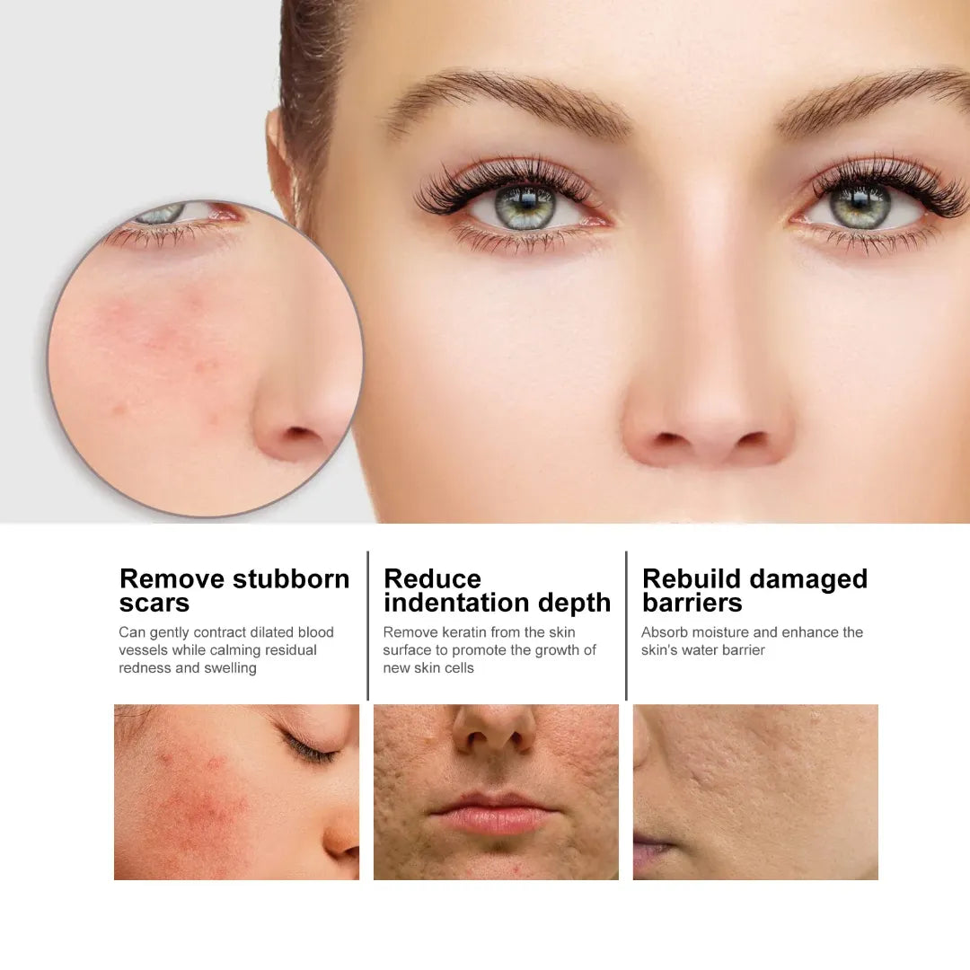 SERUM FACIAL HIDRATANTE CON NICOTINAMIDA - 50 ML Pague 1 Lleve 2